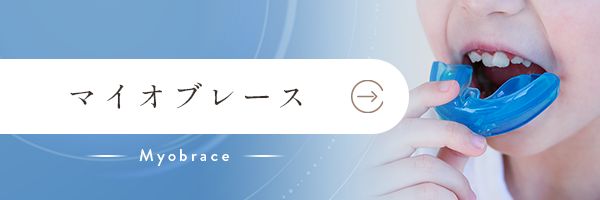 マイオブレース